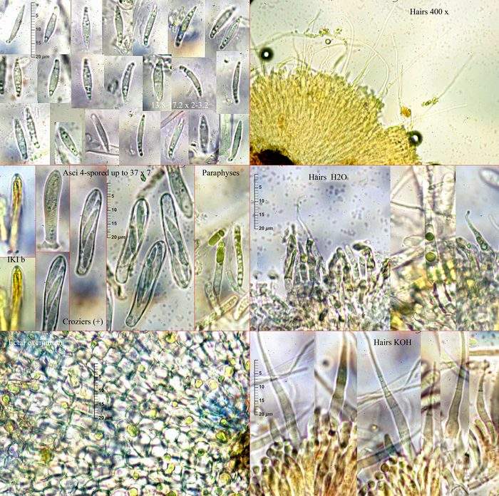 macrostoma