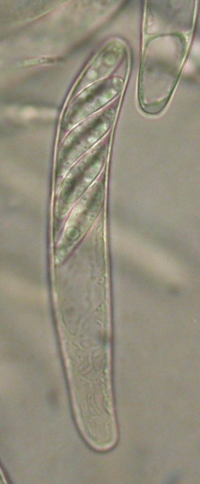 macrostoma