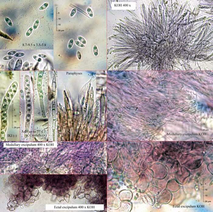 macrostoma