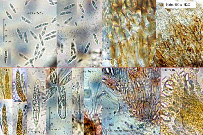 macrostoma