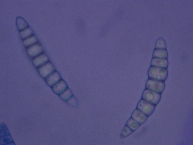 macrostoma