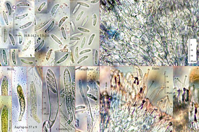 macrostoma