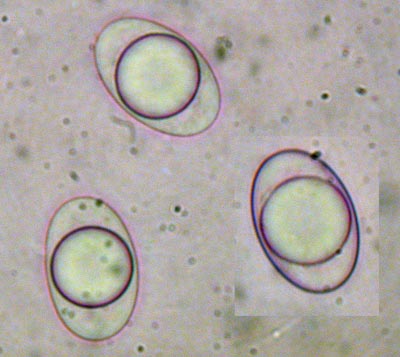 macrostoma