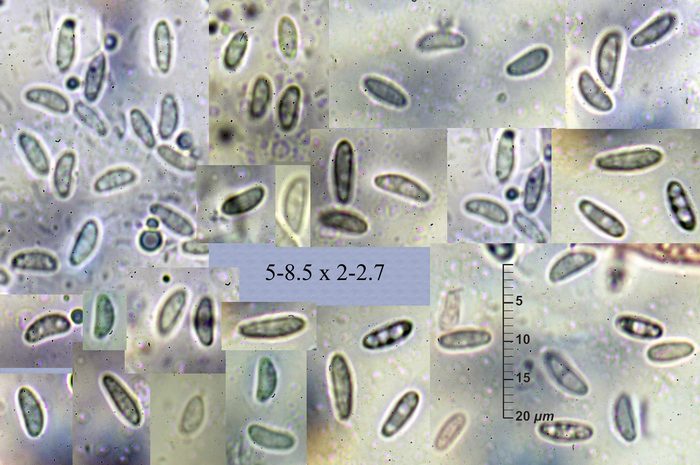 macrostoma
