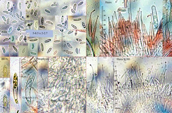 macrostoma
