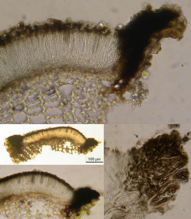 macrostoma