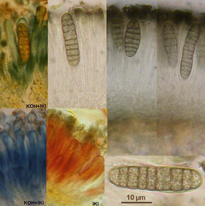 macrostoma