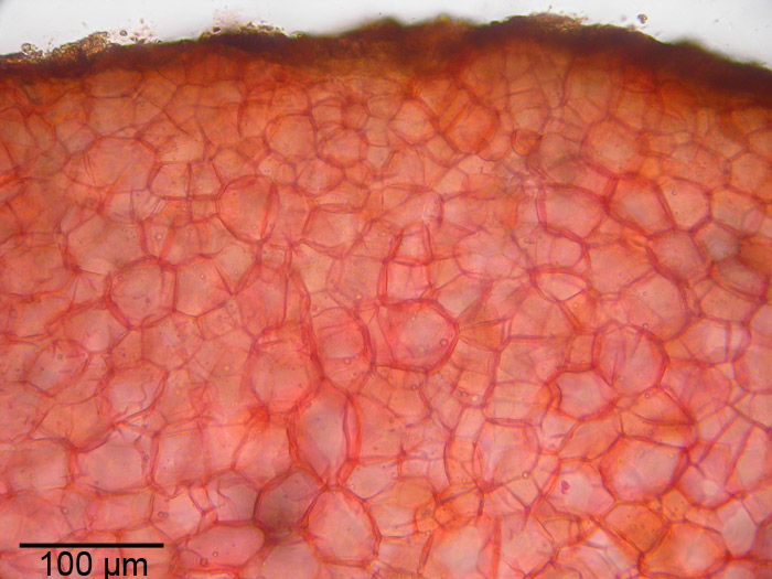 macrostoma