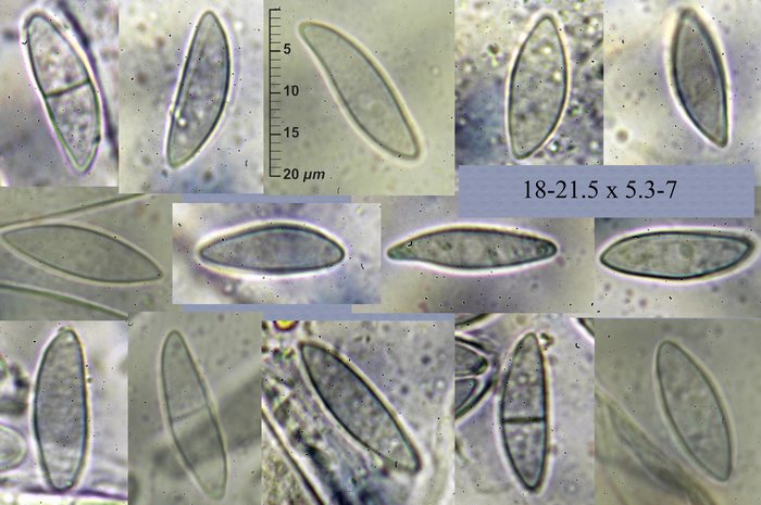 macrostoma