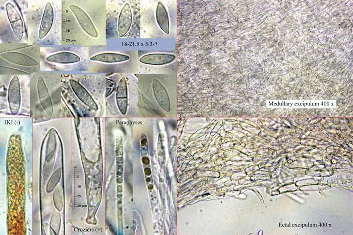 macrostoma