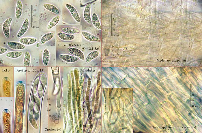 macrostoma
