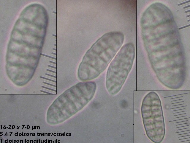 macrostoma