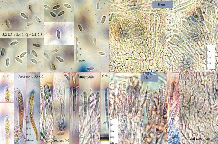 macrostoma