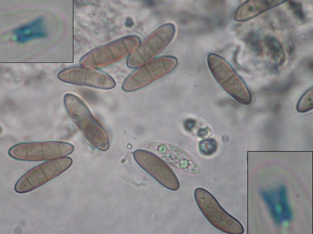 macrostoma