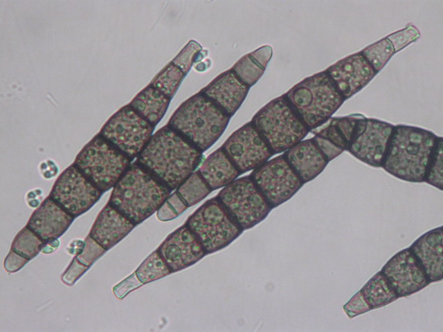 macrostoma
