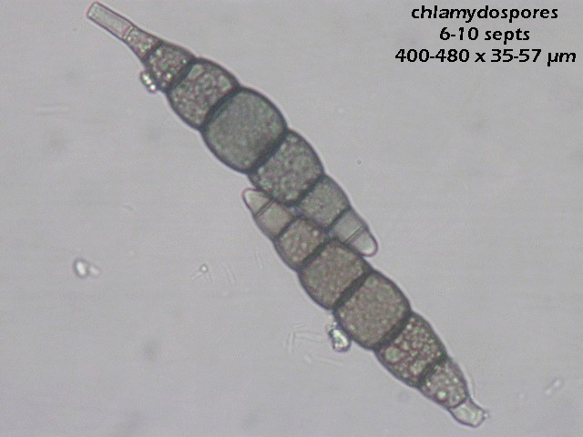 macrostoma