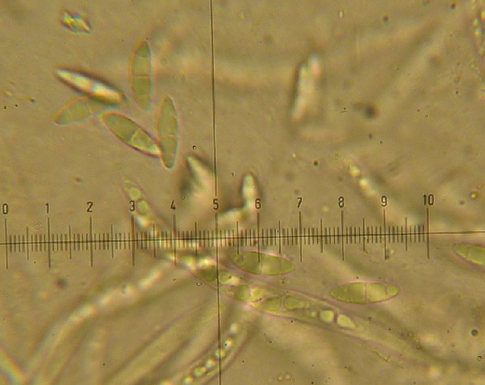 macrostoma