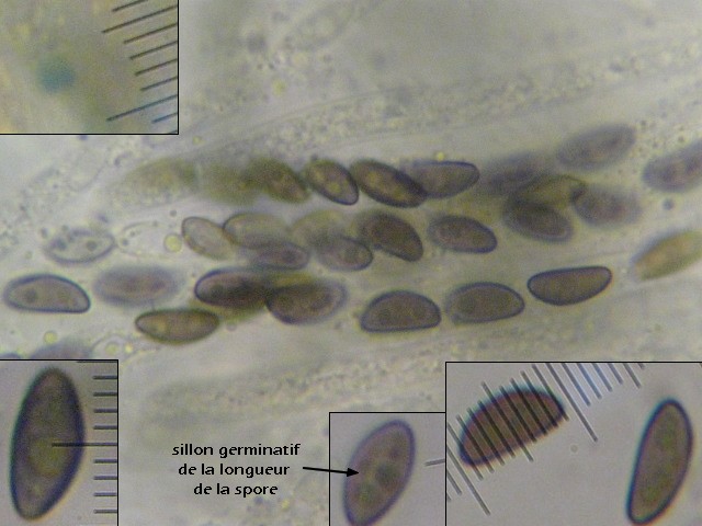 macrostoma
