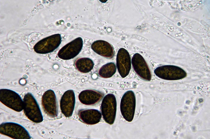 macrostoma