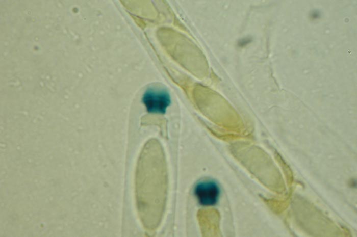 macrostoma