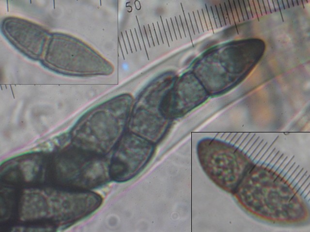 macrostoma