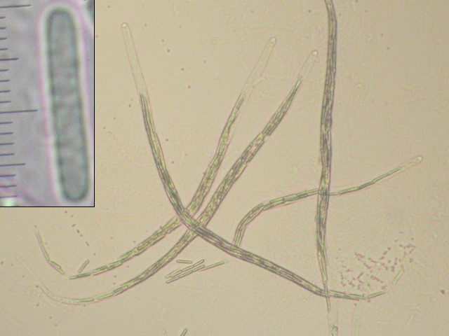 macrostoma