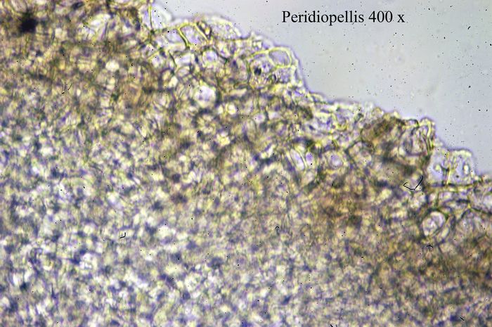 macrostoma