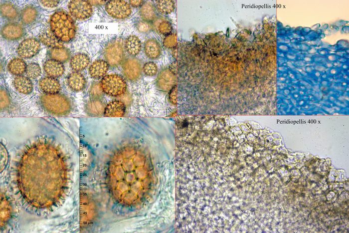 macrostoma