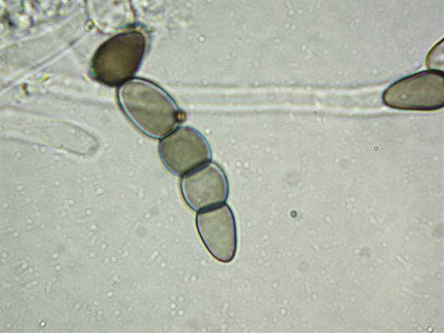 macrostoma