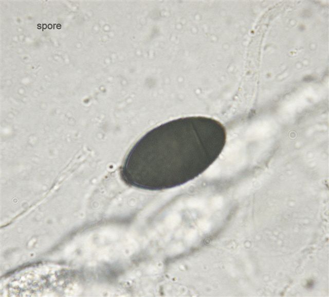 macrostoma