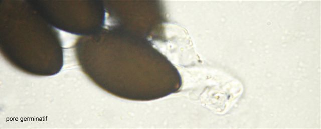 macrostoma