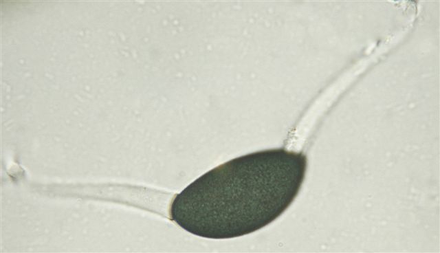 macrostoma
