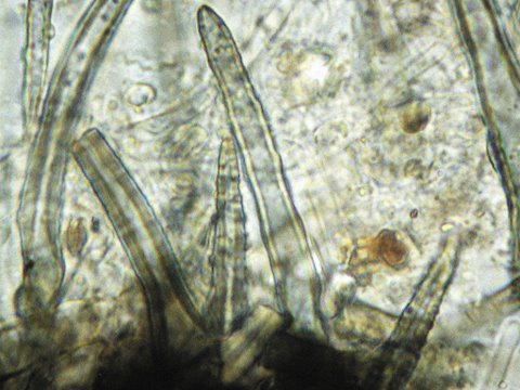macrostoma