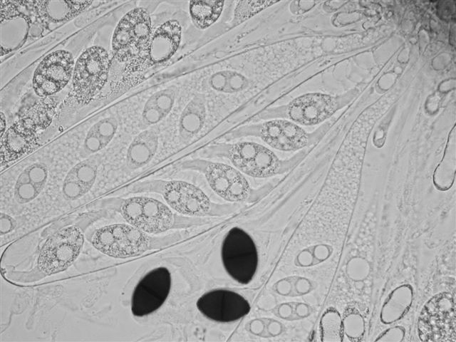 macrostoma