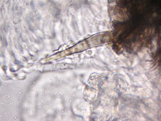 macrostoma