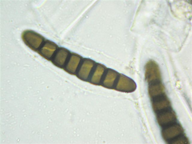 macrostoma