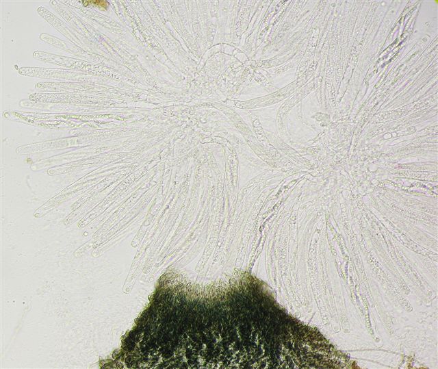 macrostoma