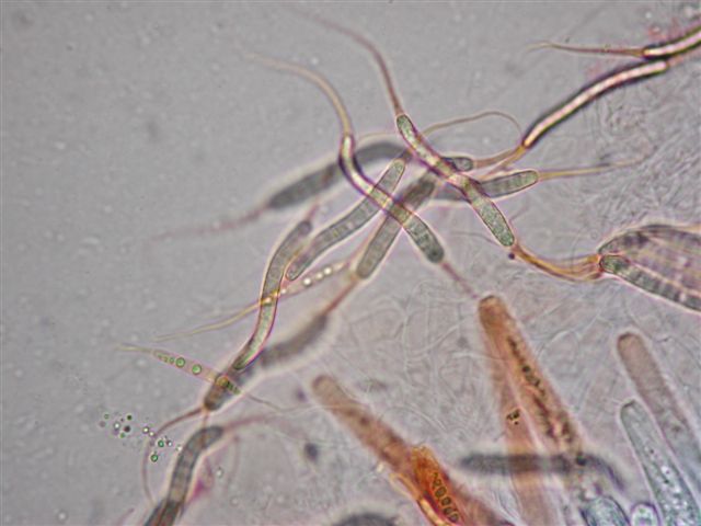macrostoma