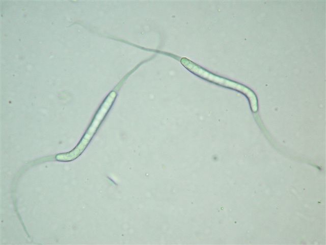 macrostoma