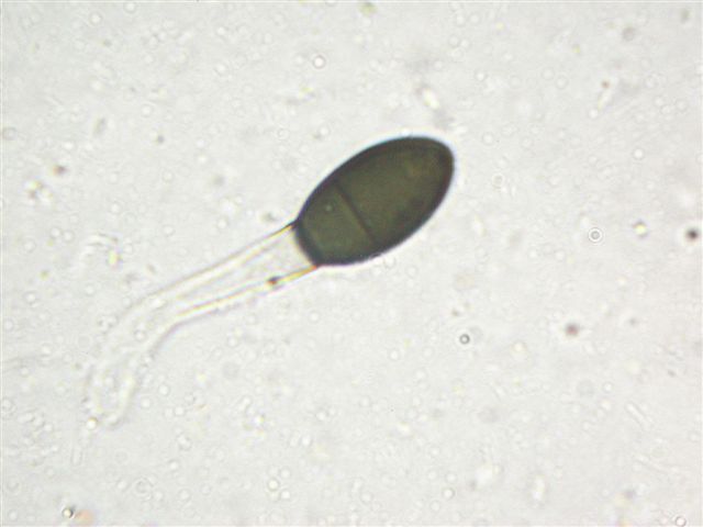 macrostoma