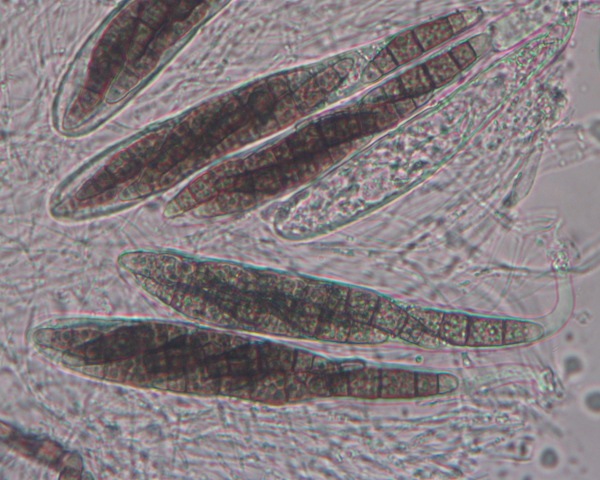 macrostoma