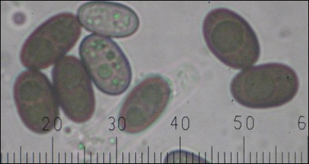 macrostoma