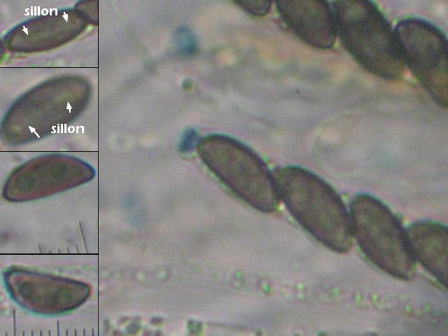 macrostoma