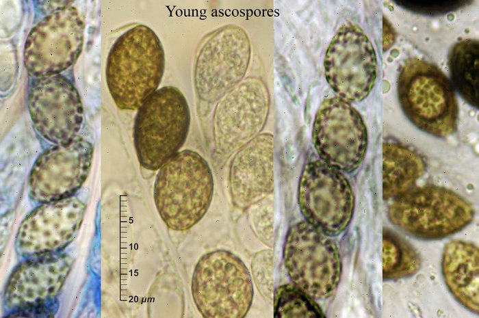macrostoma