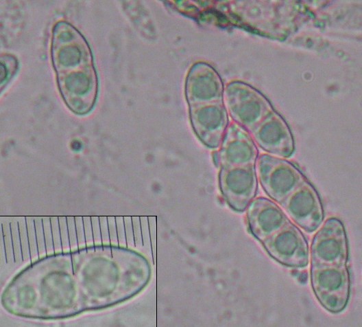macrostoma
