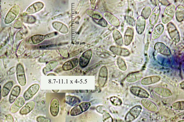 macrostoma