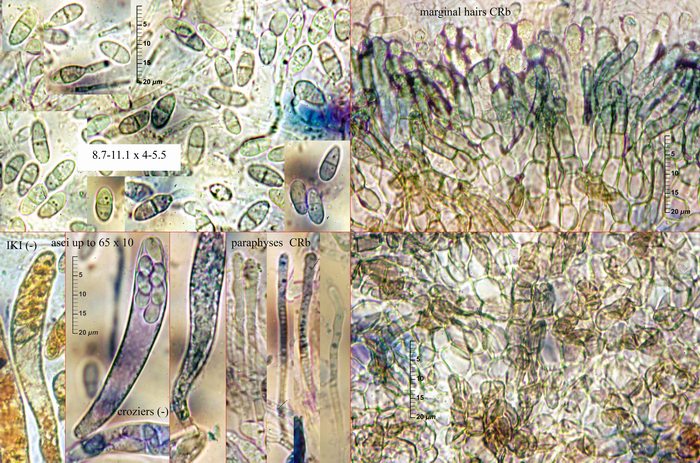 macrostoma