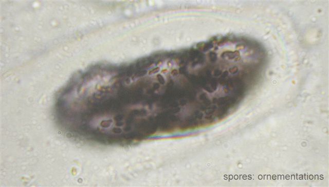 macrostoma