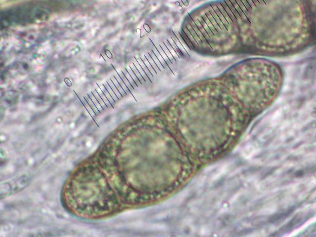 macrostoma