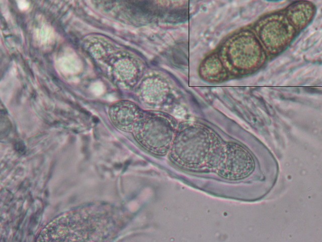 macrostoma
